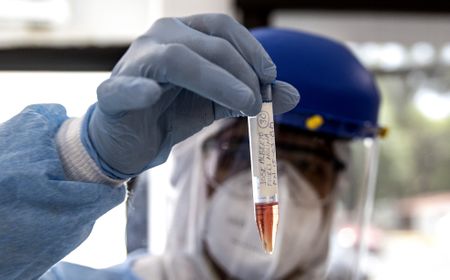 Covid-19: An antibody-based serology test provides little to no real-time value