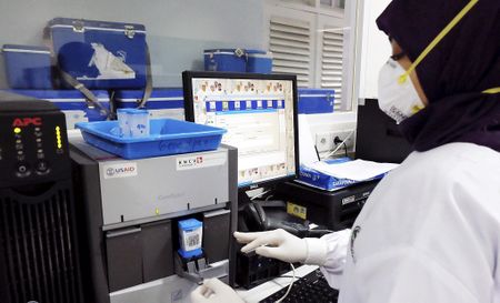 Behind SA’s shortages of test materials