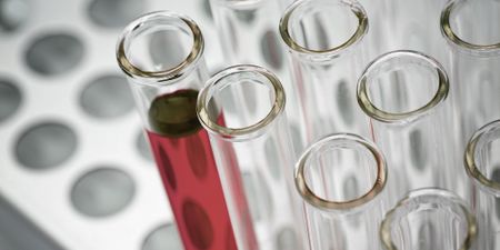 DNA samples gathering dust: DA says the police must work with the private sector to resolve the backlog