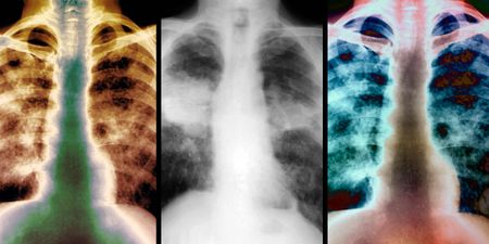 First payments to claimants in historic silicosis settlement set for second quarter of 2020