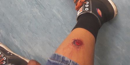 Community journalists under fire on the xeno frontline