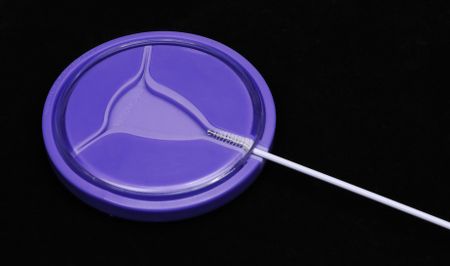 Cervical cancer a disease of poverty and inequity — inclusive treatment access is essential