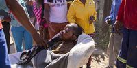 Community members claimed that this man is mentally challenged. He was shot in the head by police on Wednesday in the township of Seweding near Mahikeng and has remained untreated. A community member was wheeling him around on a wheelbarrow hoping to find transport to a local hospital.   Picture: Daily Maverick