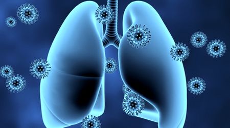 Sound the alarm: We are failing to meet targets to beat TB, but Khayelitsha’s care model during Covid-19 shows exactly how it should be done