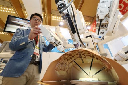 Parkinson's disease may start in appendix, study finds