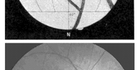 Lowell's chart of the spokes of Venus and an opthalmoscope photograph of the blood vessels diverging from the optic cup. Image: NASA Astrophysics Data System