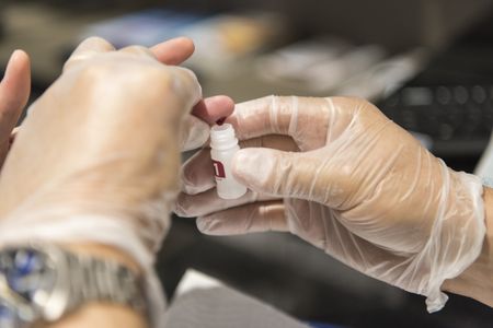 Trying to prevent and diagnose HIV at the same time – a Catch-22?