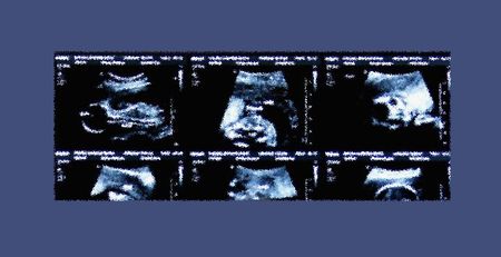 When human life begins is a question of politics – not biology