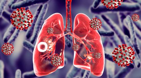 Three lessons the Covid-19 pandemic taught us about tackling TB