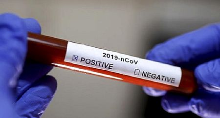 Health Department says stigma around Covid-19 growing as community leaders excluded from official response