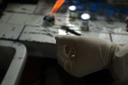 Tuberculosis deaths rose during pandemic, reversing years of decline - WHO
