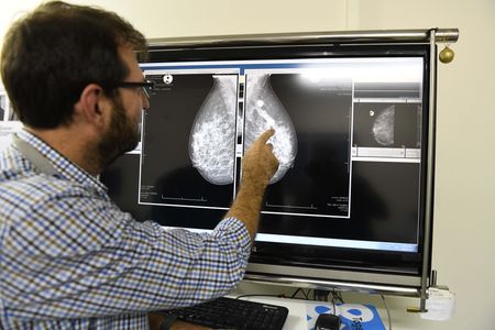 How a team at Groote Schuur is beating breast cancer against the odds